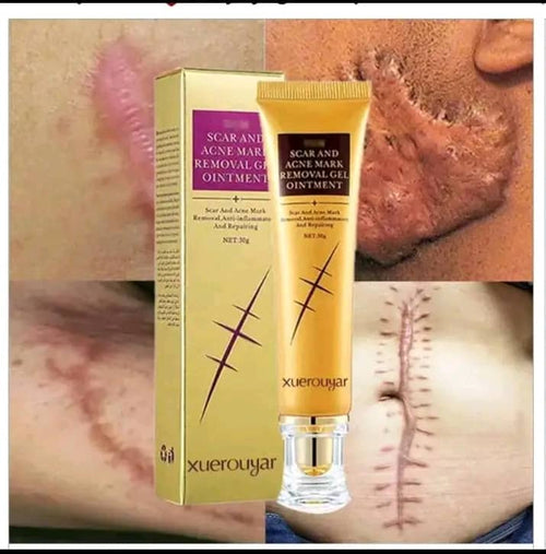 Crème Anti-Cicatrisation - Pour une Peau Lisse et Éclatante